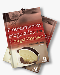 Procedimentos Ecoguiados em Cirurgia Vascular