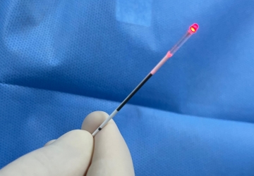 Laser Endovenoso